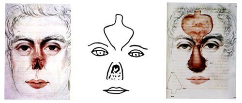 Plastics-_Facial_recon-_history-_P2_500_213_80_c1